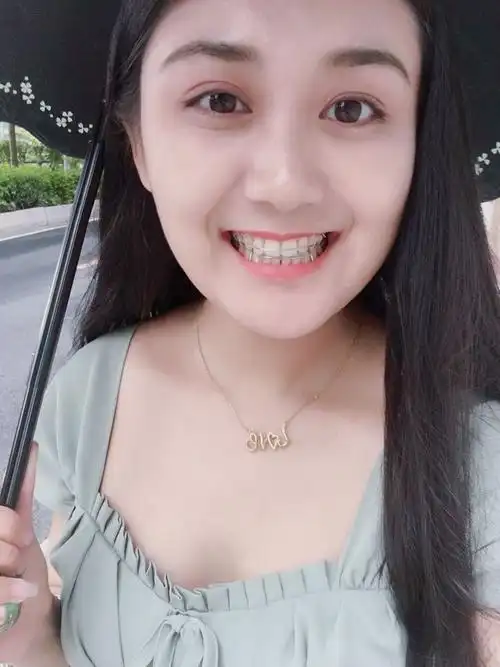 有虎牙的女生就不好看吗就一定要虎牙矫正吗北京牙齿矫正