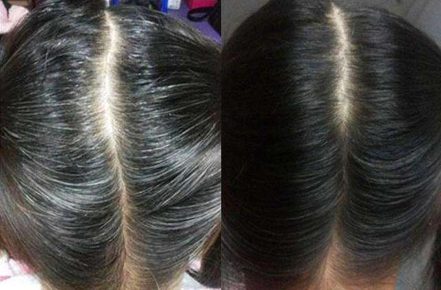 王伦堂 | 白发变黑 中医有方法