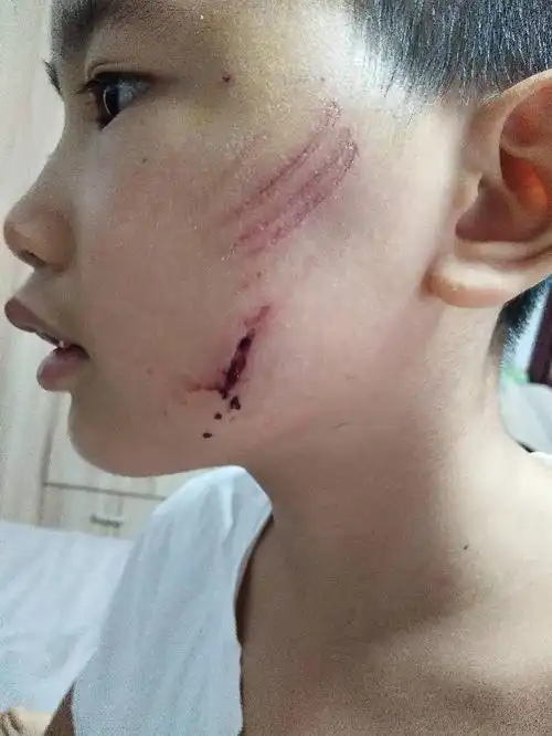 不知道怎么可以去掉这个