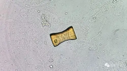 尿酸结晶的形态