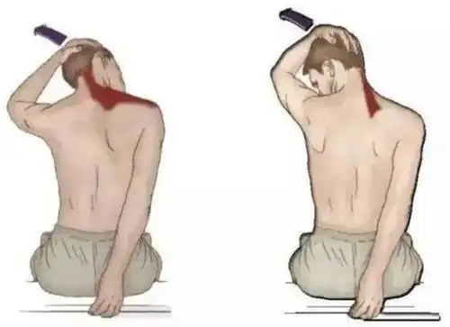 斜方肌与肩胛提肌拉伸