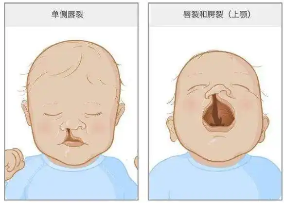 胎儿畸形是怎样造成的?多数都与宝妈的行为有关