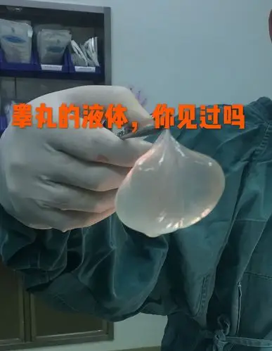 睾丸变大了需要警惕