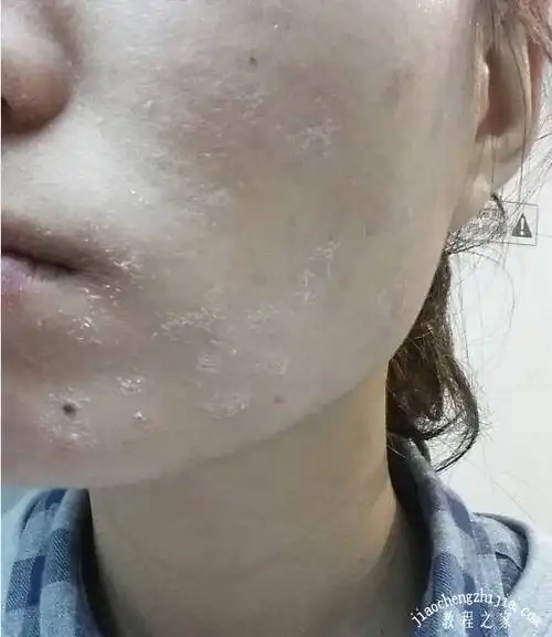 皮肤干燥吃什么好 脸部皮肤干燥怎么办