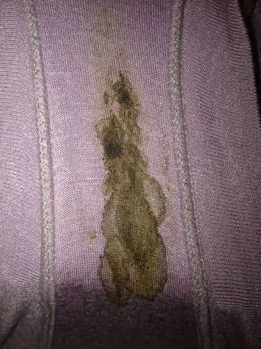 排卵期分泌出褐色的分泌物,是怎么回事?要