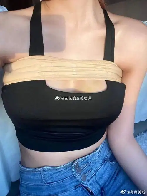 【粉丝求助】杭州脂肪隆胸医生