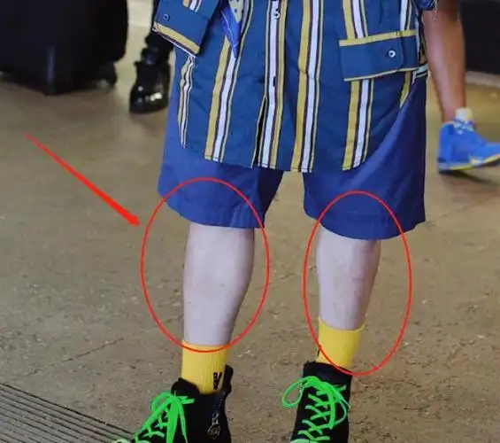 可以看得出来,蔡徐坤的小腿非常细,而且皮肤也很白,甚至连腿毛都没