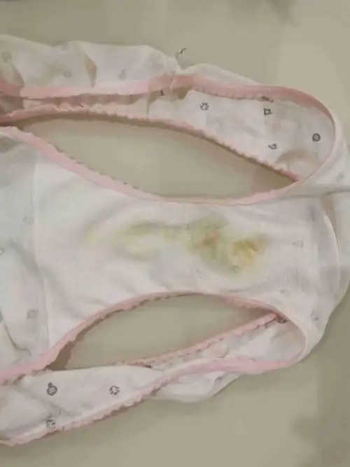 不知道白带这个算不算正常