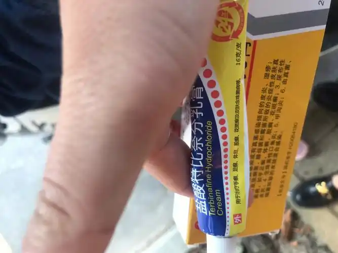 而且还开始发痒,伤口周边的地方也有了,到最后背后全都是才开始重视