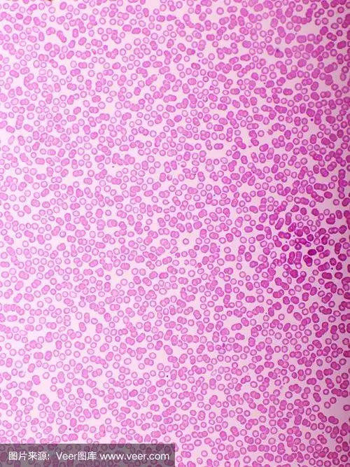 血液涂片中的红细胞