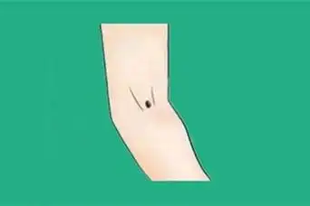 女人右手臂内侧有痣代表什么 - 起名网