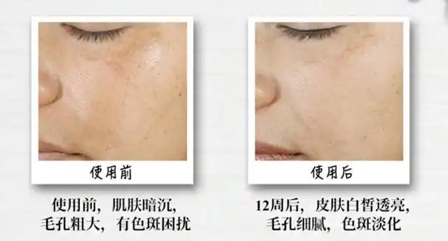 天玺皇牌特证(二)▏美白系列