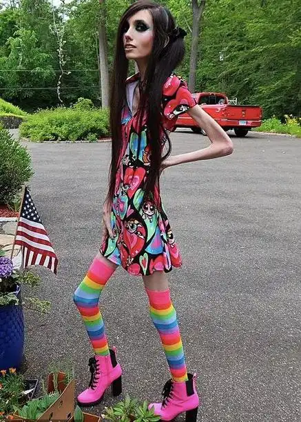 国外厌食症美女走红:瘦到皮包骨也要扮芭比