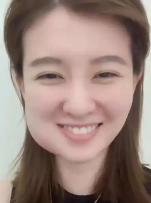 景甜拔牙后脸部肿一半牙齿上粘连血迹素颜双眼皮褶子不太自然