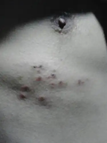 近几天胸部无缘故皮肤红肿有米粒状,不知什么症,有懂的么?谢了