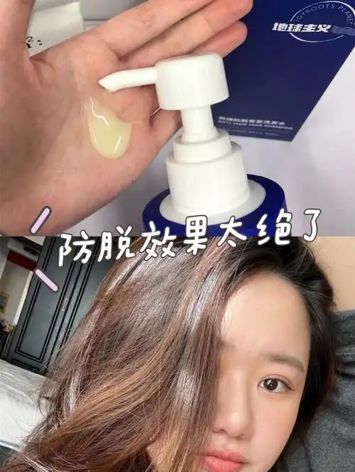 价格不过百的防脱发洗发水