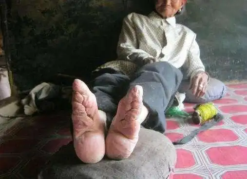 三寸金莲真的很美吗