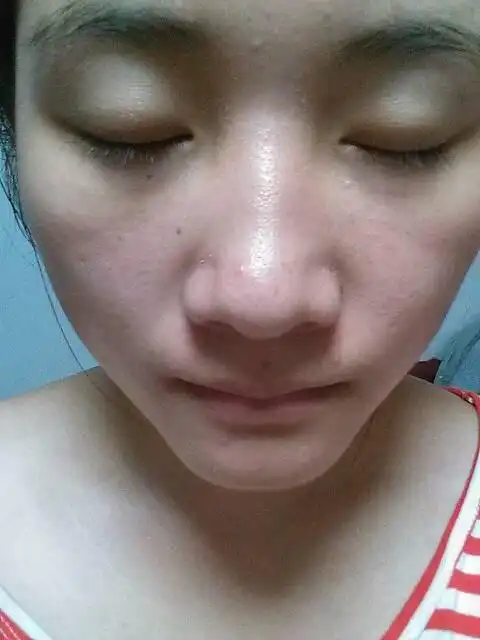 我的皮肤鼻子那一块毛孔特别大,还有黑头,皮肤比较粗糙,该怎么办