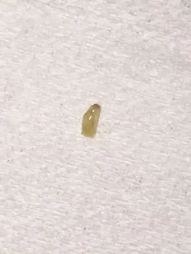 脸上毛孔里面挤出来一粒一粒白白的有点硬的那是叫螨虫还是油脂粒?