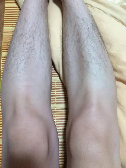 像这种腿型弯曲有得治那_百度知道