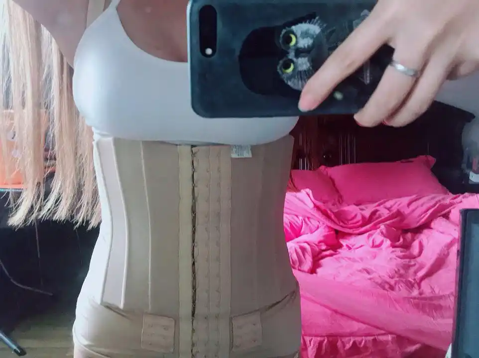 腰腹环吸真人案例._腰腹_吸脂_百度怎么样_玻尿酸_炎症_美妆_医美整形