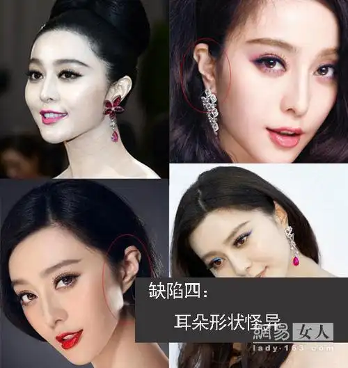 身体缺陷四:耳朵形状怪异