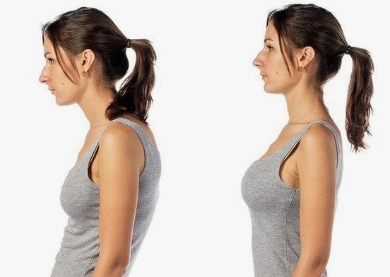 人人都可以治愈脖子前倾,摆脱手机带来的通病