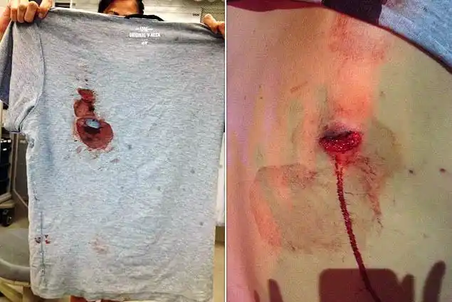 丹佛枪击案纽约幸存者展示血衣