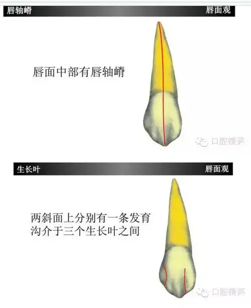上颌尖牙(上3)如此复杂?学习了