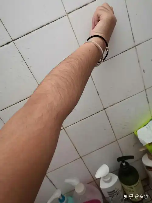 为什么有的女生体毛较多必须脱毛