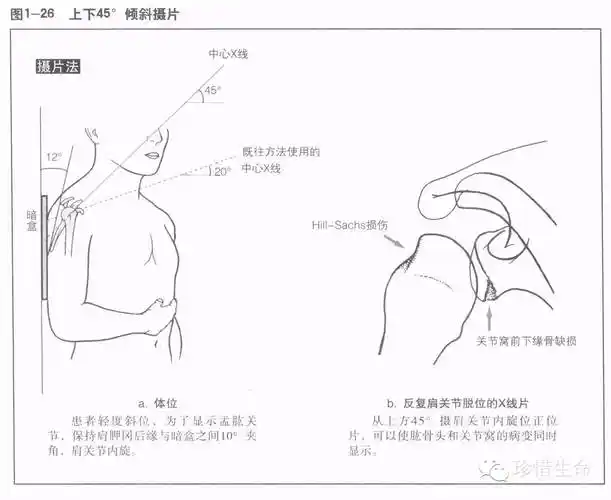 肩关节x线检查体位大全