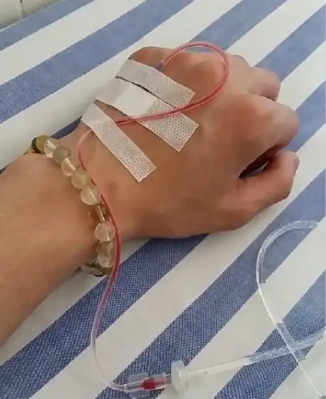 输液针管血液回流害怕知道这原因便淡然置之