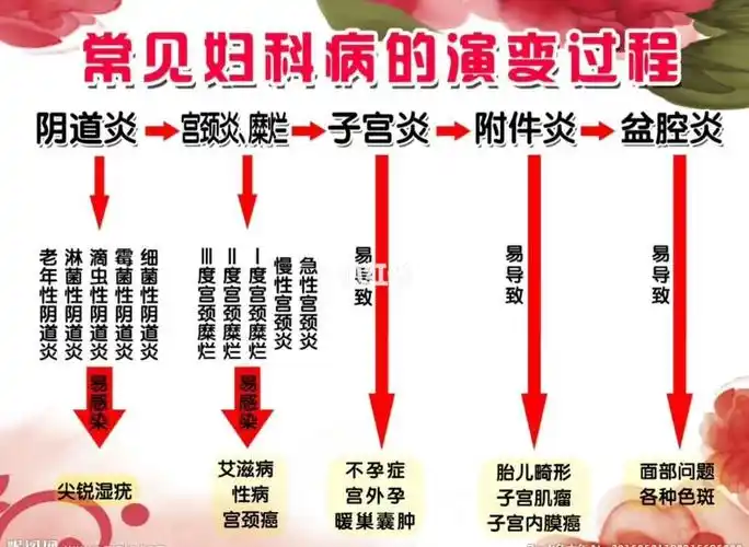 妇科炎症的演变过程