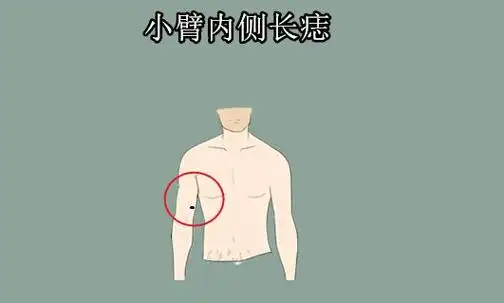 手臂上的痣的位置与命运图解超详细