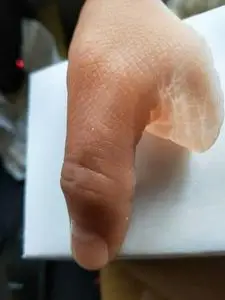 假肢义肢大拇指 仿真手指美容手指 进口硅胶美容手指套量身定做