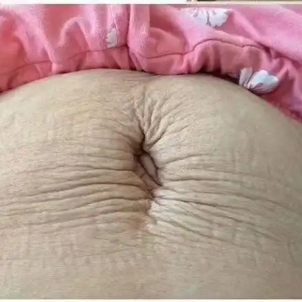 几乎看一次哭一次,到现在慢慢去接受,每次娃摸着肚子问"妈妈这是什么"