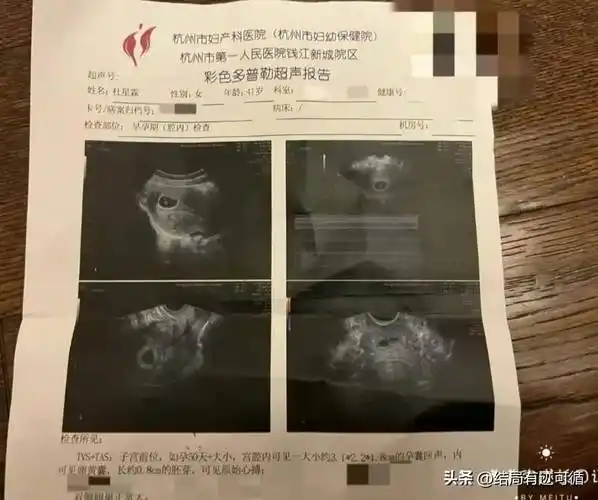 张纪中42岁娇妻官宣四胎喜讯怀孕仍美如少女网友恭喜嘟嘟爸