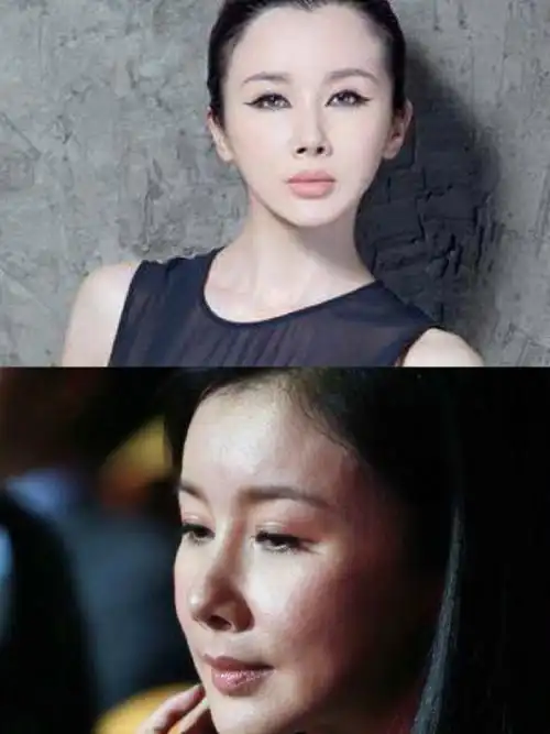 孙菲菲是如何从第一古典美女变成了整容狂