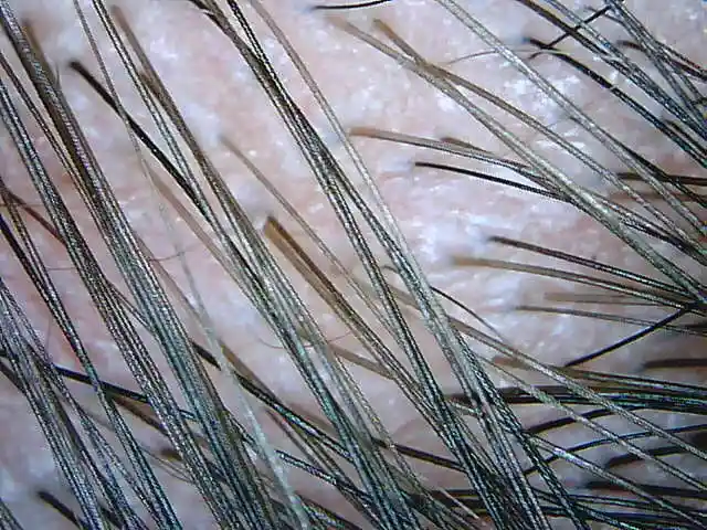 hotwifiusb两用无线数码显微镜皮肤发根检测