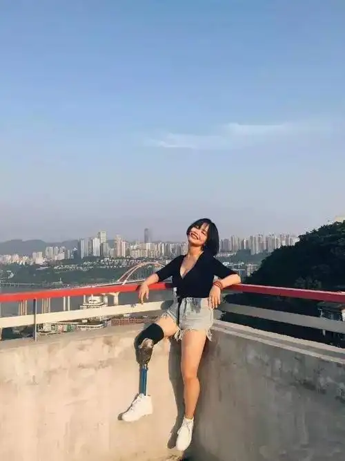 95后最酷独腿女孩露假肢穿短裙出席联合国会议却拒绝包装偏偏不做励志