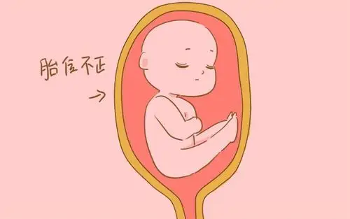 胎位不正怎么办?用这两个方法纠正很有效,妈妈不妨试试_胎儿