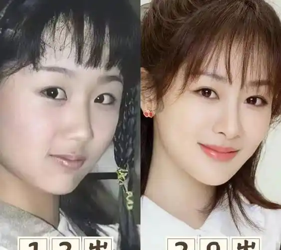 杨紫到底有没有整容?网友直言:敢做不敢认?_事情_女明星_照片