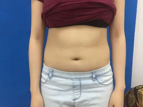 两个多月过去了,整个人看起来就是九十斤左右了