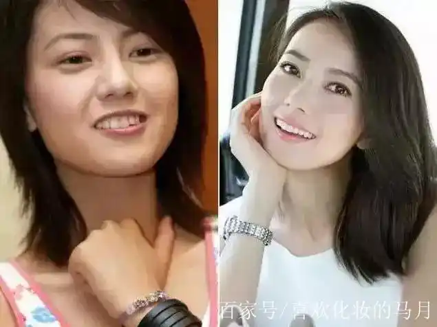 高圆圆出道前旧照扒出,前后对比判若两人,换了牙齿像换张脸