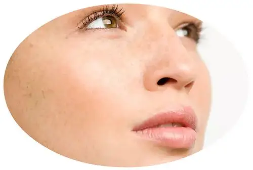 史上最全面部色斑分类和调理方法!