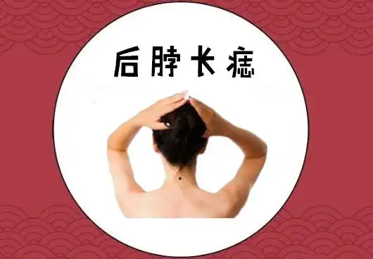 后脖长痣在相学当中,若是在脖子后边的位置处长有吉痣,则会被称之为暗