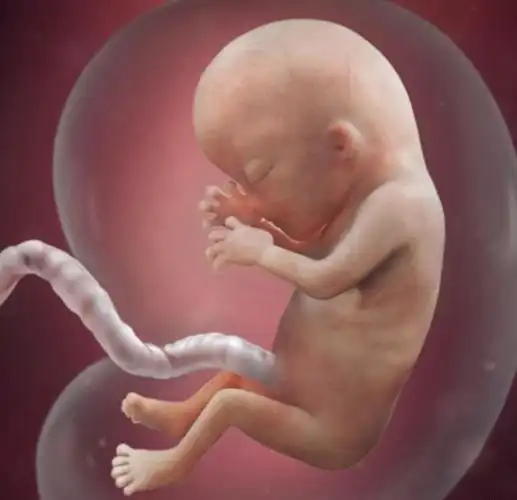 想保持羊水"清澈",孕期做到4不碰,宝宝住着更舒心|胎儿|孕妇|分娩