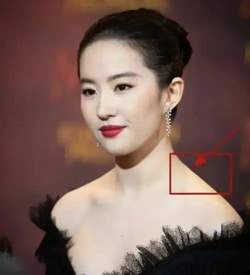 首先是她本身是滑肩,发福之后肩膀变得又厚又圆,斜方肌突出,脖子看