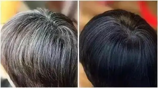 一撮白发,显老10岁!一个动作让你白发变黑,不花一分钱!