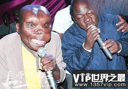 世界上最恶心的人,又丑又恶心的男人和女人(图片)(3)